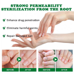 20ML Nutraboost Nail Fungus Treatment Gel, Natural Nail Repair Strengthening Gel Free Shipping